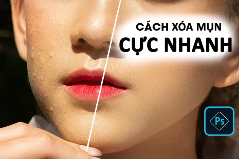 Cach xoa mun cuc nhanh